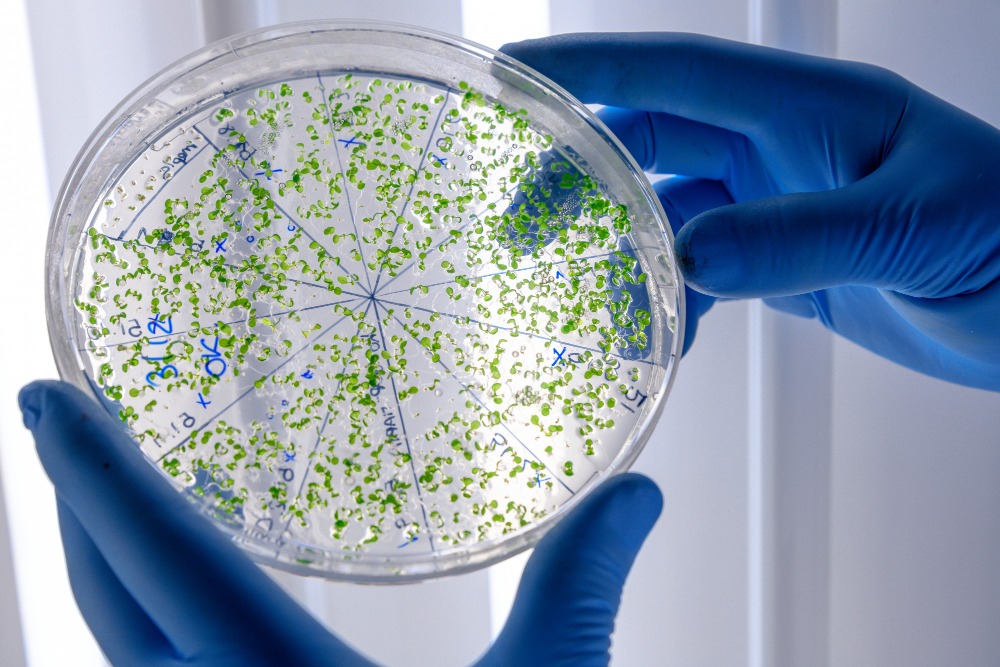 Décès en France du premier patient connu infecté par le virus de Shamonda : ce que l’on sait de cette infection / Reuters